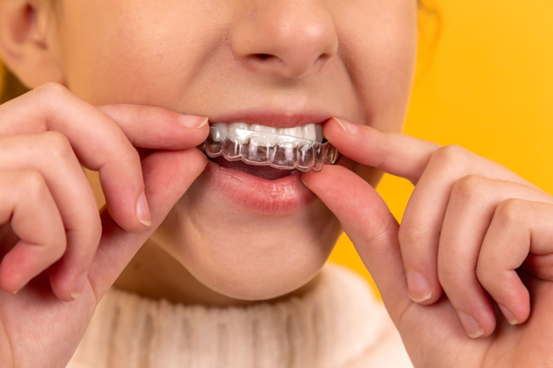 ¿Duele ponerse un implante dental? El proceso y el postoperatorio real 1 Colocación de implante dental proceso quirúrgico